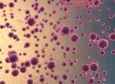 Proteínas y COVID persistente