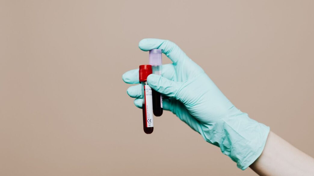 Descifran el mensaje oculto del ADN en sangre que predice el regreso del cáncer más letal de piel