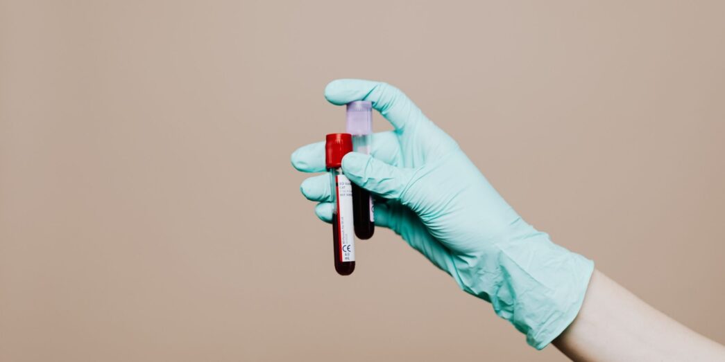 Descifran el mensaje oculto del ADN en sangre que predice el regreso del cáncer más letal de piel