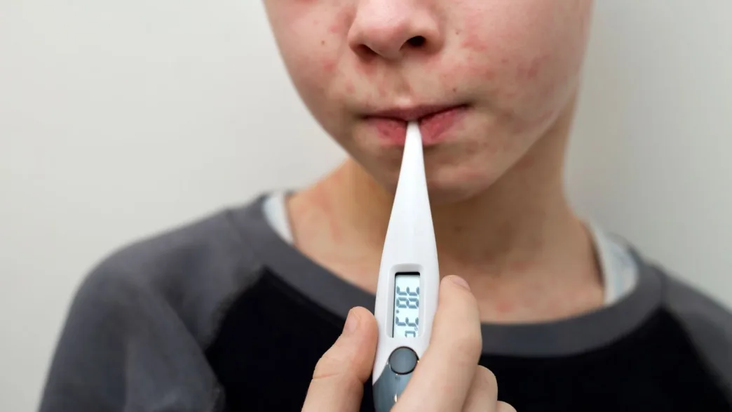Un estudio advierte que una bajada del 5 % en las vacunas infantiles podría duplicar los casos de sarampión en Texas
