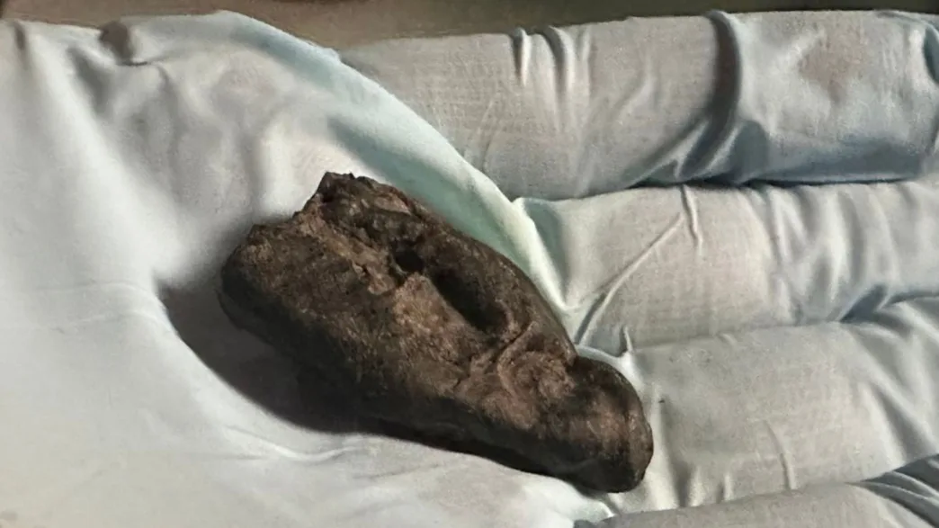 La resina de corteza de abedul presenta huellas de dientes y conserva restos de saliva humana