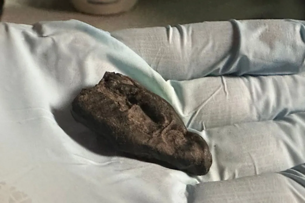 La resina de corteza de abedul presenta huellas de dientes y conserva restos de saliva humana